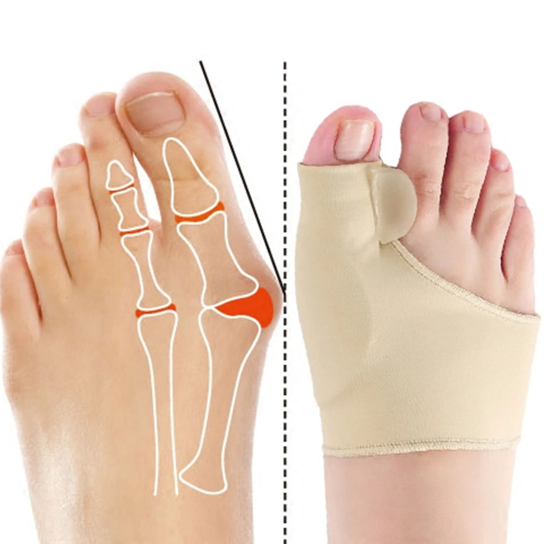 hallux-valgus-silicone-protective-sleeve-toe-valgus-corrector-big-toe-valgus-fixator-for-men-and-women.jpg_Q90.jpg_ (1)