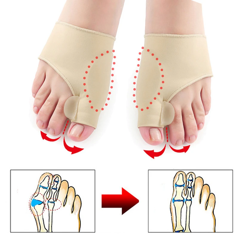 hallux-valgus-silicone-protective-sleeve-toe-valgus-corrector-big-toe-valgus-fixator-for-men-and-women.jpg_Q90.jpg_